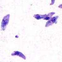 toxoplasma gondii